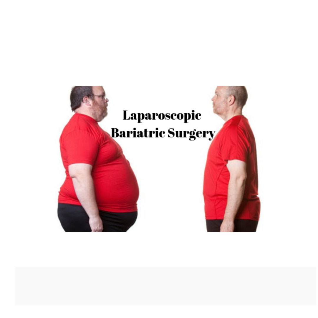 Appendix Surgery