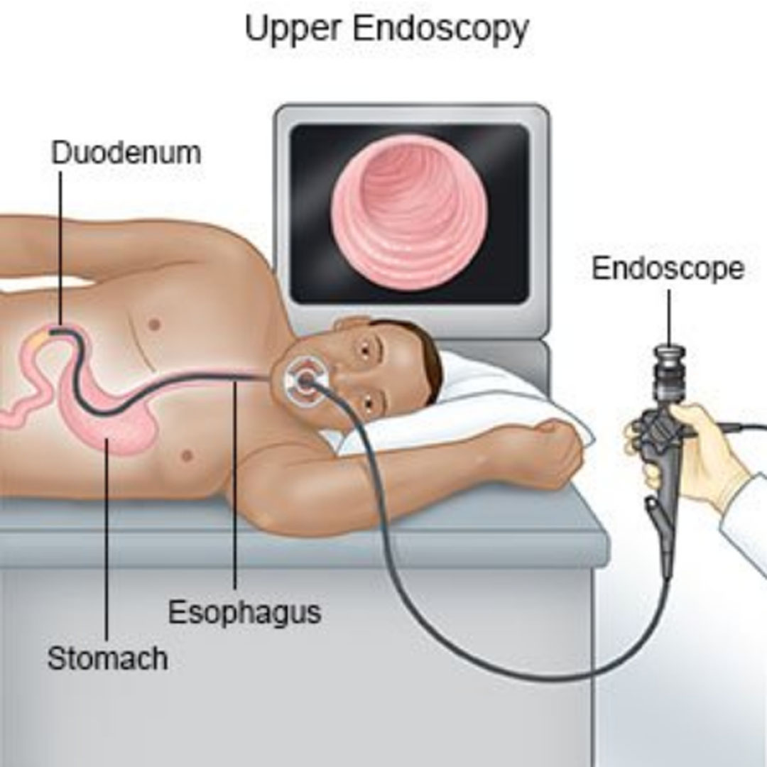 Appendix Surgery